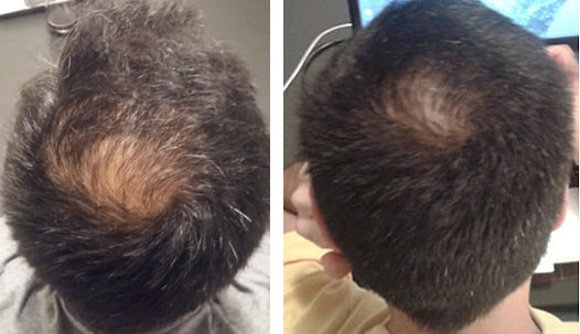 RESEED R8 Botanical Solution for Men 50 ml - Reseed Hair Loss Range for Men and Women