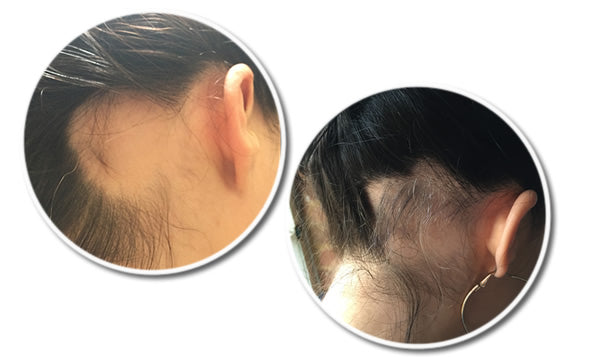 R12 Tri Peptide Hair Growth Serum for Women 30 ml - Reseed Hair Loss Range for Men and Women